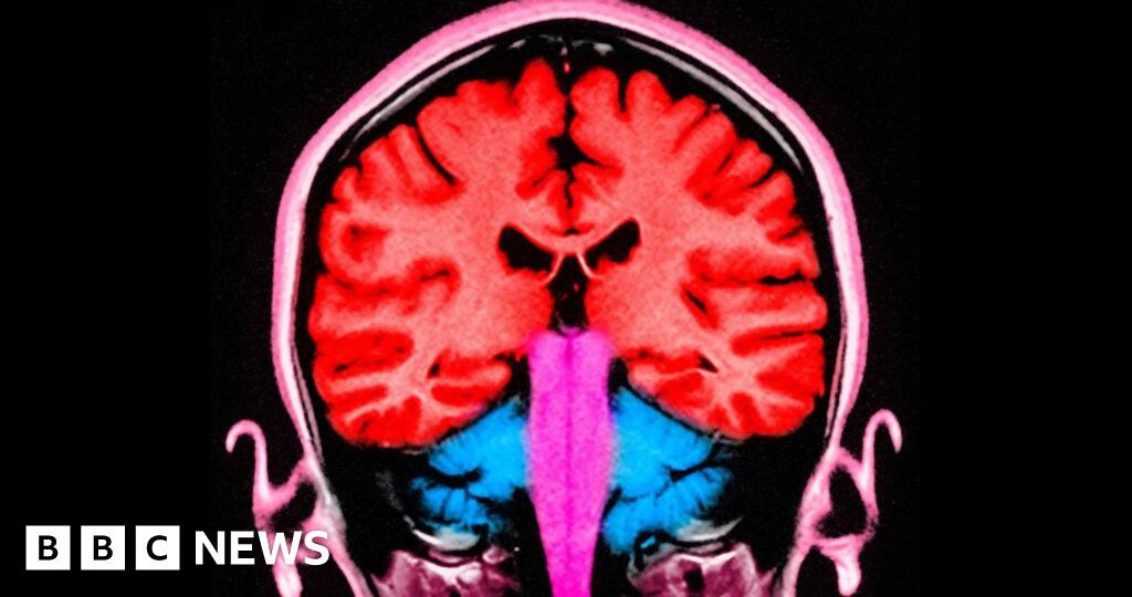 Can-a-pulse-of-electricity-to-the-brain-make-us-le