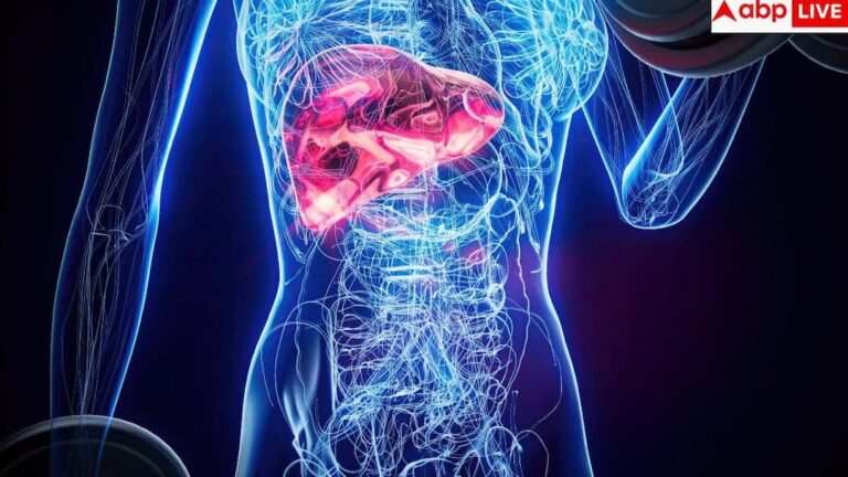 Fatty-Liver-Disease-फैटी-लिवर-क