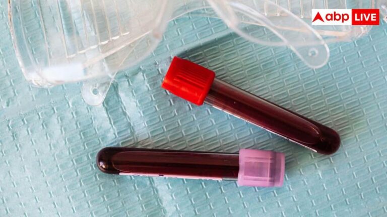 nipah-outbreak-in-kerala-aayaa-aaya-a