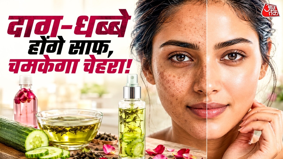 30-में-आ-गई-झाइयां-खी