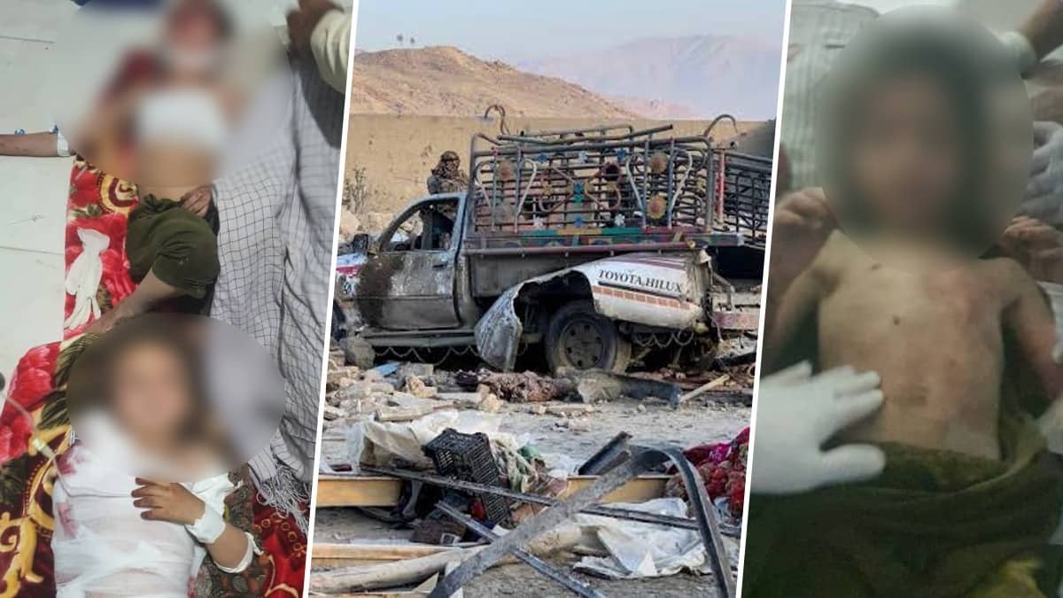 ‘Act Of Brutality’: Kabul Tears Into Pakistan Over Cross-Border Strikes, Releases Haunting Images Of Injured Children
